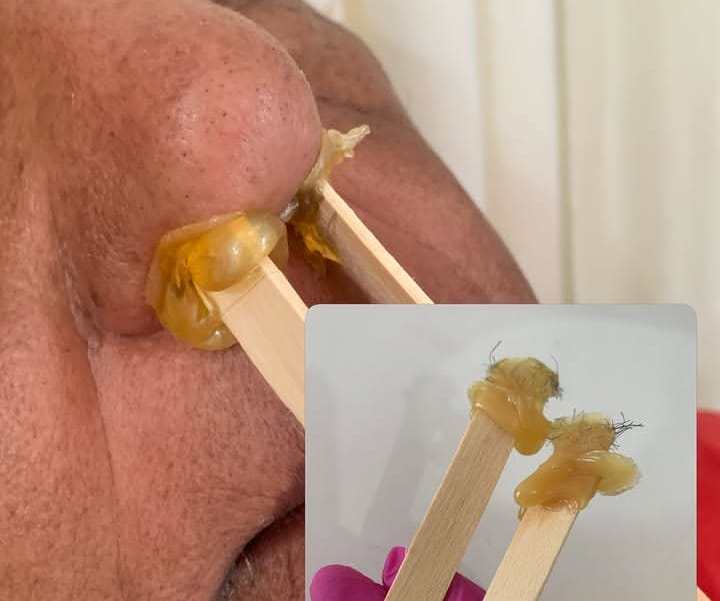 Depilação facial com cera de alta qualidade